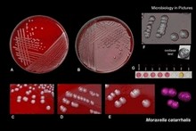 moraxella